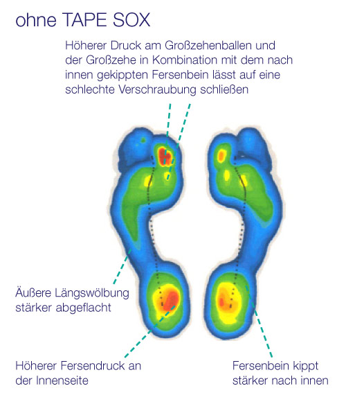 Druckmessung ohne COMPRESSANA Tape Sox