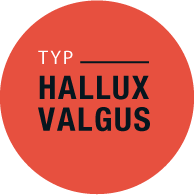 Typ Hallux Valgus