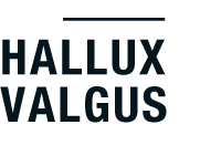 Typ Hallux Valgus