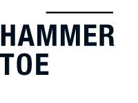 Typ Hammerzehe